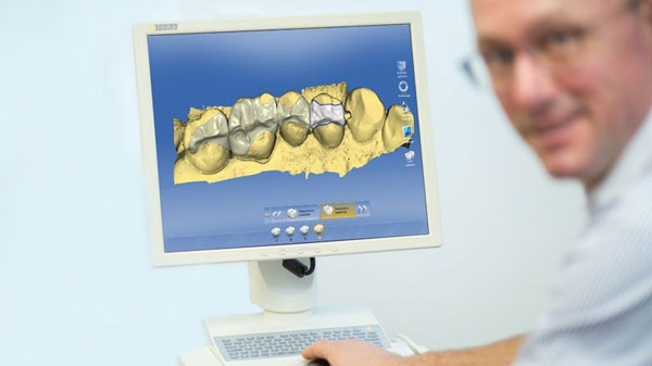 Abdruckfreie Praxis , CAD-Zahntechnik- 3D-Fräs- und Drucksysteme